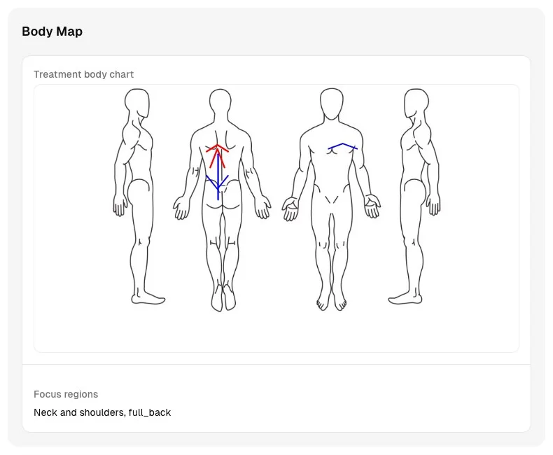 Massage treatment body chart with marked focus regions across the back and shoulders.